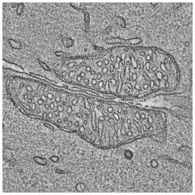 Symmetric arrangement of mitochondria:plasma membrane contacts between  adjacent photoreceptor cells regulated by Opa1